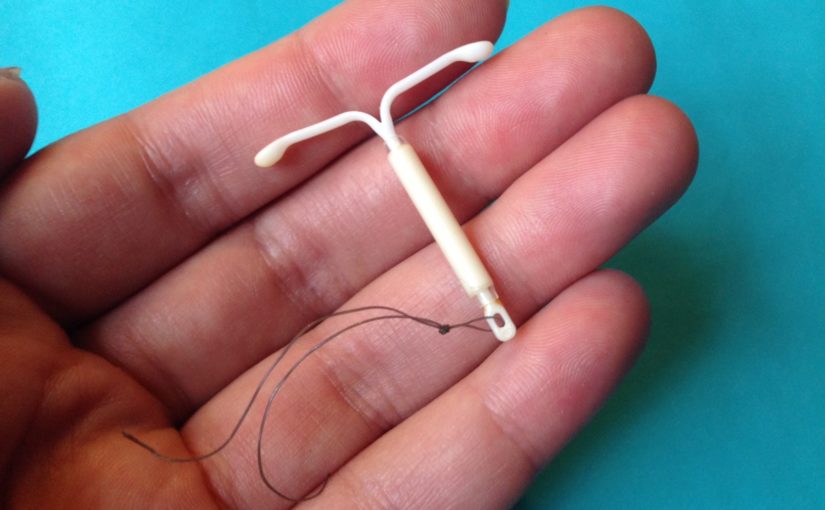 This May Be TMI – My IUD Experience